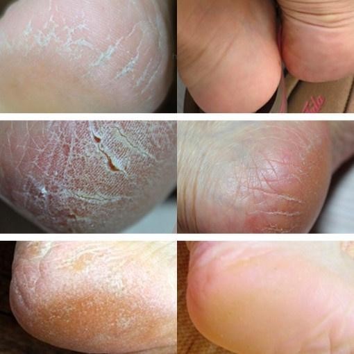 AITTE Silk Foot Cream 100ml