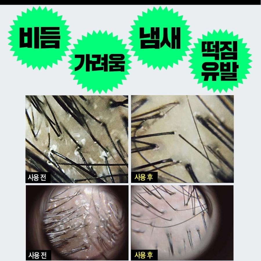LabelYoung Shocking Scalp Soda Pack 200ml